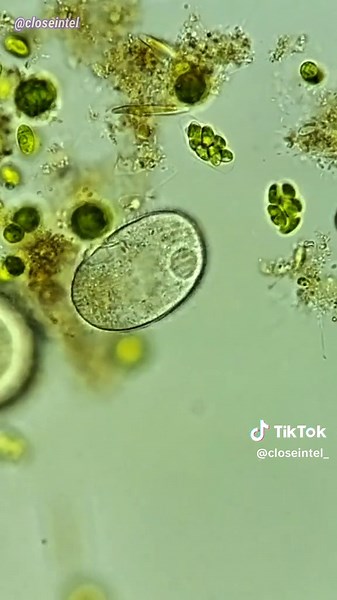 Stagnant Rain Water #undermicroscope #microscopy #microscopic #microcosmos #microworld #microtok #microbiology #cellbiology # #microscopicview #microscopetiktok