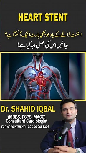 Can You Still Get a Heart Attack After a Stent? Find Out the Real Reason Why!