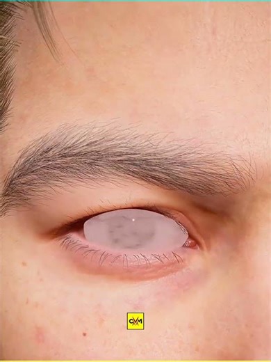 Why Is There Pink Stuff In Your Eye