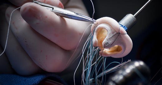 2025 Sees Major Advancements in TMVR Devices: Robotic-Assisted Procedures & Positive Outcomes Propel Market Expansion