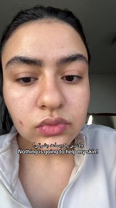 اذا انا قدرت غير بشرتي صدقيني انت كمان قادرة تغيري بشرتك✨🔥 The best investment I ever made was taking care of my skin 🤍✨ #acnejourney #clearskin #GlowingSkin #skincaretips #beautytips