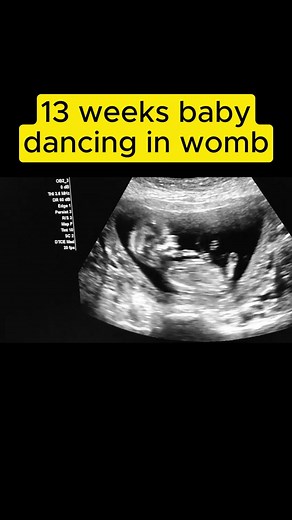 Ultrasound for pregnancy -13 weeks baby dancing in womb #babykicks #babykicking #womenshealth #foryourpage #miracles #fyp #pregnancy #pregnant #birth #babiesoftiktok #babies #pregnancyweeks #pregnancyweekbyweek #wombmates #prenataldevelopment #Uterus #shorts