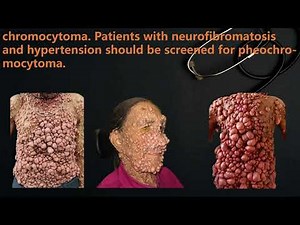 Neurofibroma: Skin Presentation, Diagnosis & Key Facts