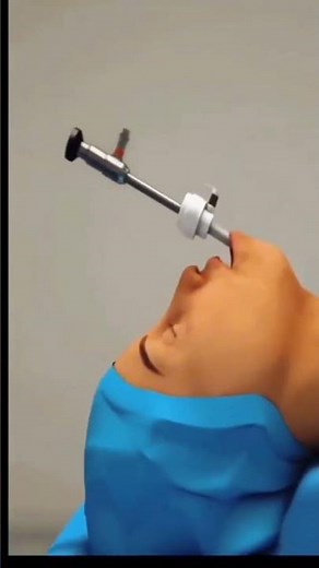 Thyroid Surgery Procedure Explained | Step-by-Step Thyroidectomy | Medical Lecture | college Planet