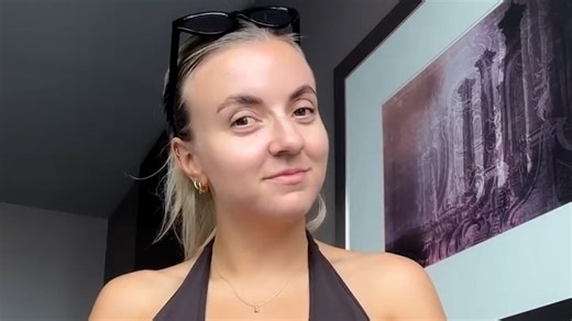 Zoe Hague shares update on botched Botox after eye left drooping