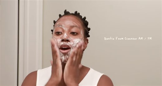 How To Beat Cystic Acne Naturally: Cycle-Syncing, Diet, & Skincare!