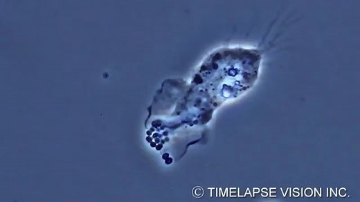 显微镜下的中性粒细胞吞噬细菌