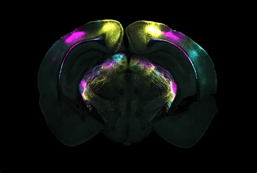 Subthalamic plasticity helps mice squelch innate fear responses
