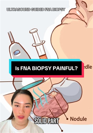 FNA Biopsy Experience: Pain and Recovery Insights