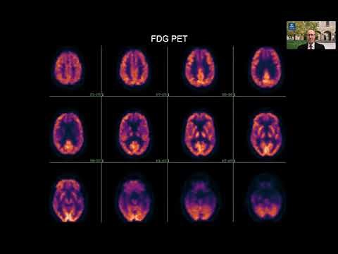 Cases- Reading FDG PET Part Two