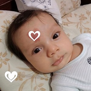 A baby was born with a unique birthmark on his forehead shaped like a heart. 💥😍His charming personality and the story behind his birthmark have captured the hearts of many. 🤗What does he look like now? 👀👉👉 Scroll down to the top comment to see his photos and how he has embraced his uniqueness! 📸⬇️⬇️⬇️ | Happy Day