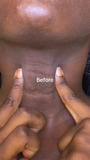 Dr. Althea Reju 5000 Cream for Neck Lines