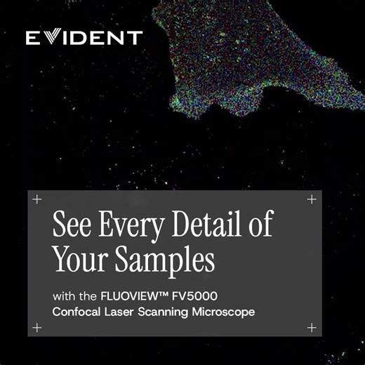 Do you struggle to keep your samples in focus? Evident's new FLUOVIEW™ FV5000 confocal laser scanning microscope’s TruFocus™ Z-drift compensation system ensures you maintain consistent focus throughout your imaging. 📸 Ideal for live-cell and multi-well plate imaging, this feature delivers sharp, reliable images that capture every detail of your samples. See for yourself with a customized demo: https://ow.ly/MkK350Xj6Ym #Imaging #Microscope | Evident Microscopy
