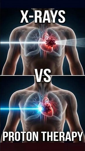 The Beam That STOPS Inside The Tumor