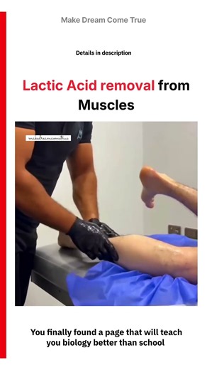 🦵 Lactic Acid Removal From Muscles 💪 | MDCT