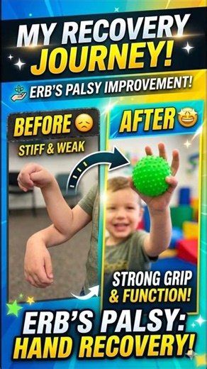 From Weakness to Strength 💪 | Erb’s Palsy Recovery Journey,#@indianotist#otist