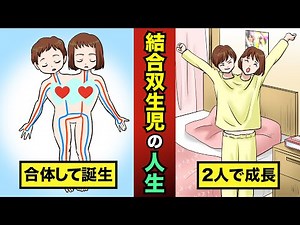 結合双生児として生まれるとどうなる？難病と付き合い方が大変・・・