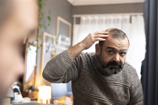 Calvície: gel de açúcar faz crescer cabelos como o minoxidil