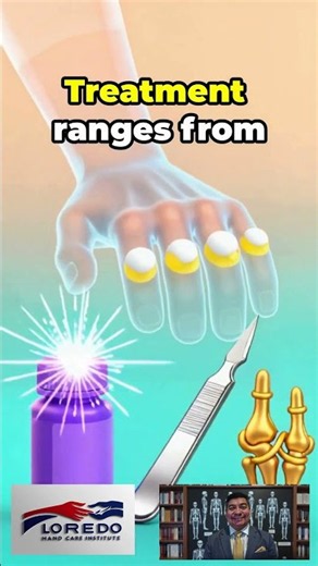 Gout in the hand does not only cause pain. It reshapes your joints and limits motion.
