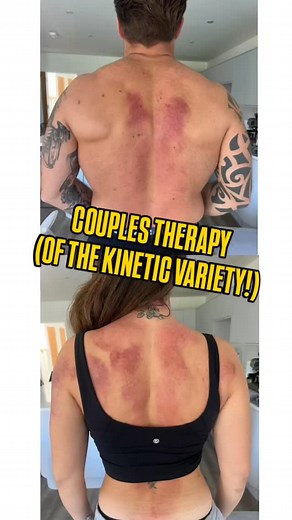 COUPLES (KINETIC) THERAPY. Had a fantastic time meeting both...