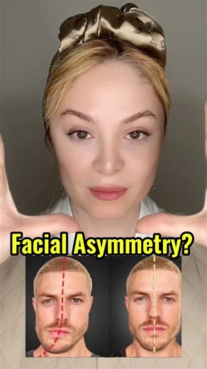 Fix Facial Asymmetry Naturally 😍 | Face Yoga Hack #facialasymmetry #facesymmetry #faceyoga