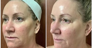 Want to have youthful-looking skin? Try this treatment at Turn Back Time Spa and Wellness Clinic