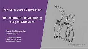 Transverse Aortic Constriction: The Importance of Monitoring Surgical Outcomes