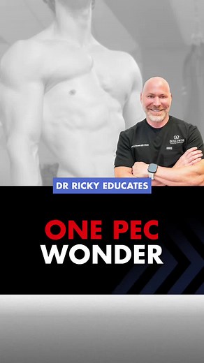 Understanding Poland Syndrome and Its Impact