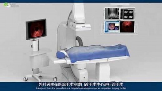 一分钟3D动画了解什么是输尿管镜检查术