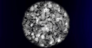 Science Cancer Research Medical Innovation Microscope Stock Footage Video (100% Royalty-free) 1101072415 | Shutterstock