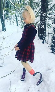 Double amputee model Daisy is showing that her differences won't hold her back from pursuing her dreams 🙌🏻 | Born Different