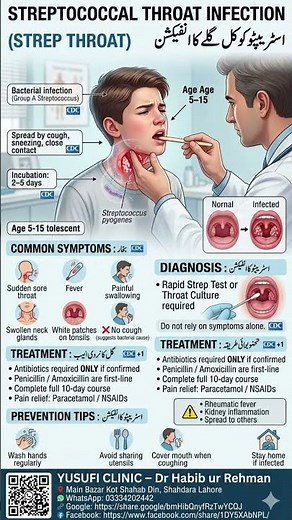 Streptococcal Throat Infection (Strep Throat) | Symptoms, Diagnosis & Treatment | Yusufi Clinic