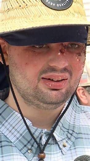 Maine firefighter injured in lumber mill explosion says his community makes him feel like a hero
