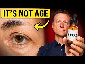 The Big Iodine Mistake 50% Of People Are Making