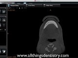 CBCT Viewing Software 101 • Video • MEDtube.net