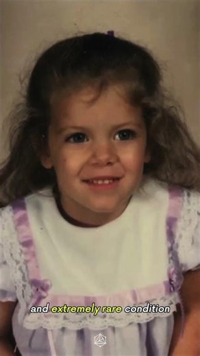 Did This Woman Blind Herself!?