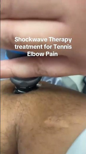 Shockwave Therapy treatment for Tennis Elbow pain.