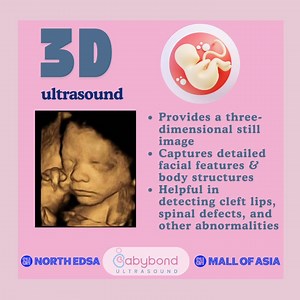 Curious about the difference between 2D, 3D, 4D, and 5D ultrasound?🤔✨ 👶 2D – The traditional black & white ultrasound, great for checking baby’s health and development. 🍼 3D - Gives a clearer, more detailed image of your baby’s face and features. 💖 4D – Like 3D, but in motion! See your little one’s movements in real-time. 🌟 5D / HD LIVE – The most advanced, high-definition imaging with lifelike colors for the most realistic view of your baby! Experience the magic of seeing your little one b