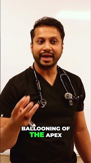 Tako-Tsubo Cardiomyopathy: Stress, Ballooning Heart, and Clean Cath