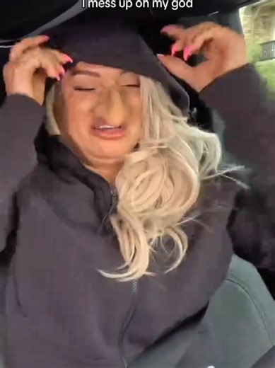 These botched plastic surgery pranks are insane 🤣🤣🤣 #prank #viralvideo #couple #funny #fyp