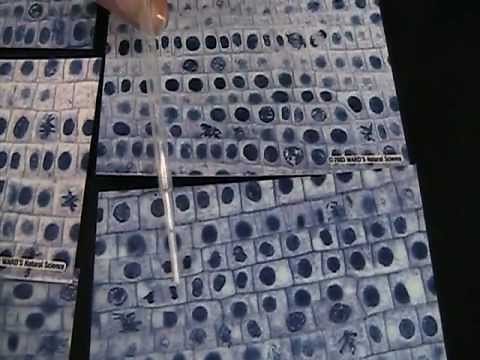 identifying cells in mitosis stages