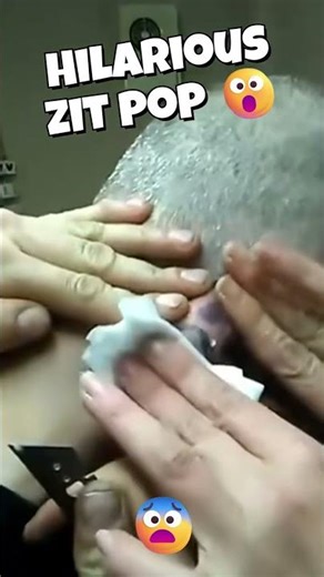 Most Explosive Pimple of 2025 😱😨