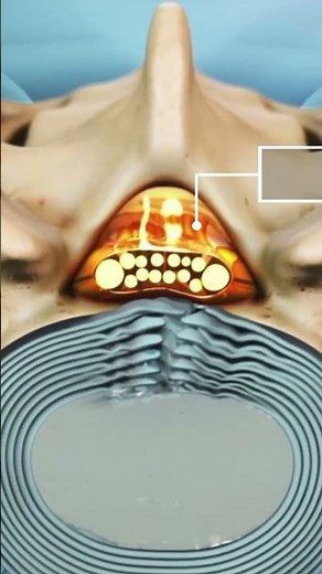 What are the Nerves Contained in the Thecal Sac?