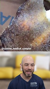 206K views · 661 reactions | SUPER clean pull from this pore mask! (credit: @cureme_medical_complex on TT) #satisfying #porestrips #pores | Dr. Dustin Portela, Dermatologist | Facebook