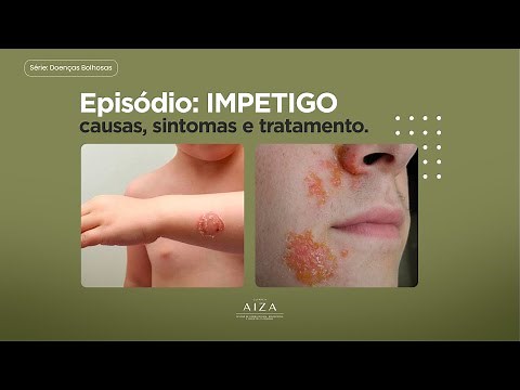 Doenças bolhosas | Impetigo: causas, sintomas e tratamento.