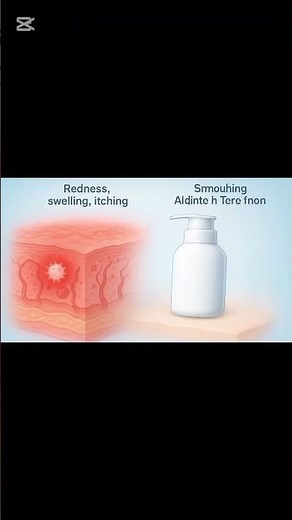 Dimed Lotion | Skin Redness, Itching & Allergy Fast Relief | Betamethasone Dipropionate