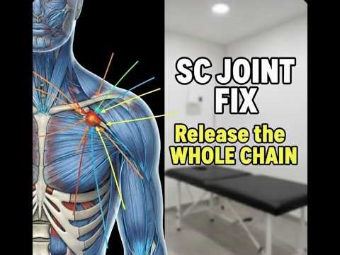 Severe SC Joint Pain Relief: The Trigger Point & Fascia Release Method