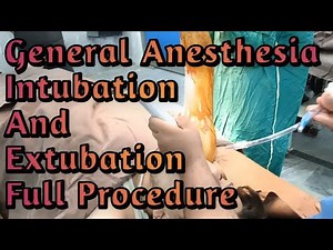 General Anesthesia Intubation & Extubation Procedure | General Anesthesia | Anesthetic Waseem
