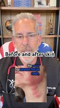 Skin ivermectin topical cream