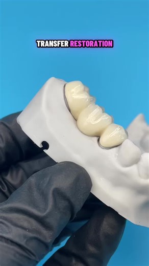 Want to get a price list,please contact my WhatsApp: 86-15393729102, WhatsApp link: http://wa.me/8615393729102, our sale coworker will tell you more details, like brochure...#dentist#dentallab#teeth#denture #dentaltreatment #3Dprinter #Thefastest laboratory #crowns #Dentalimplant #Zirconiacrown #PFM #CAD #CAM